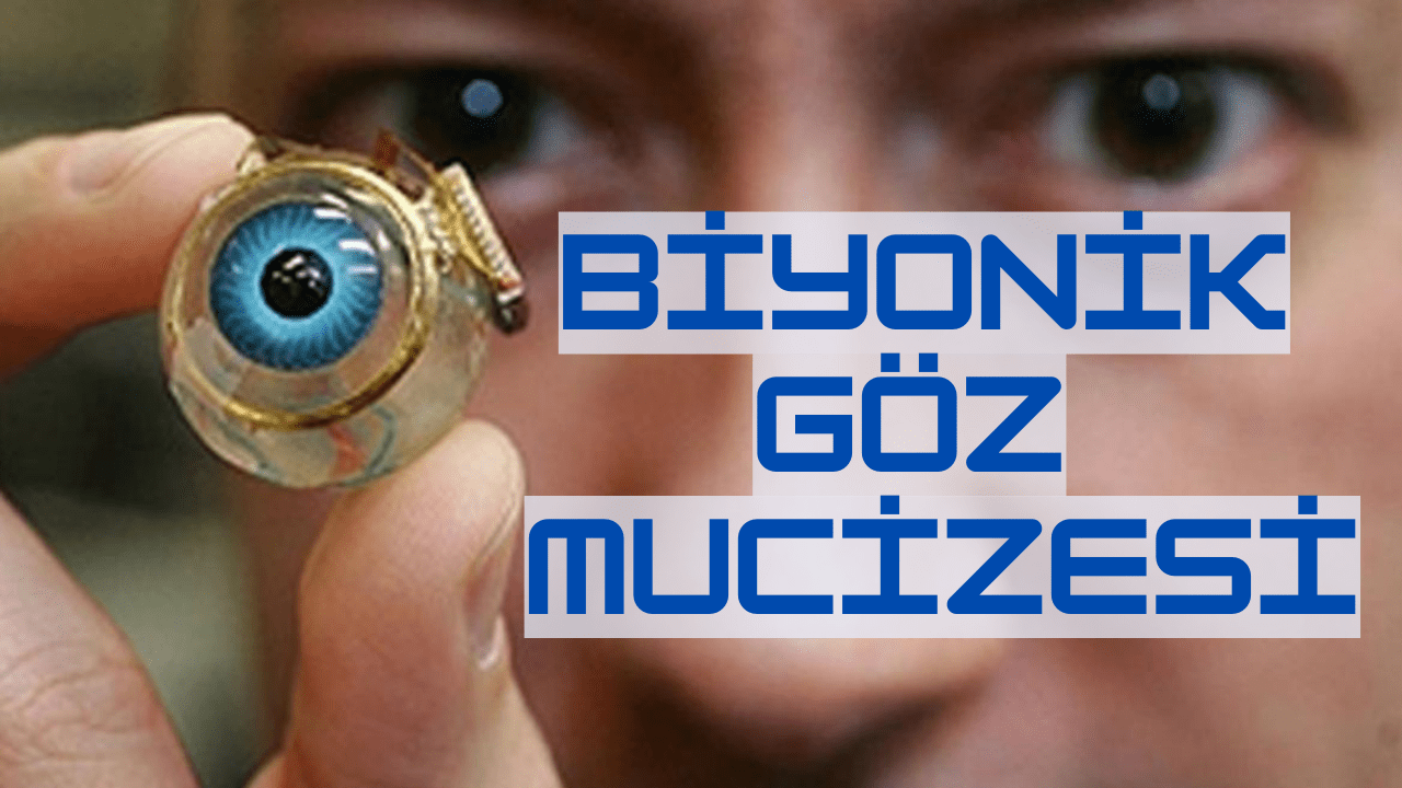 Görme Engelli İnsanlar İçin Biyonik Göz Mucizesi 3 Görme Engelli İnsanlar İçin Biyonik Göz Mucizesi