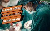 Ölümden Sonra Canlandırılan Domuz Beyinleri 7 Ölümden Sonra Canlandırılan Domuz Beyinleri